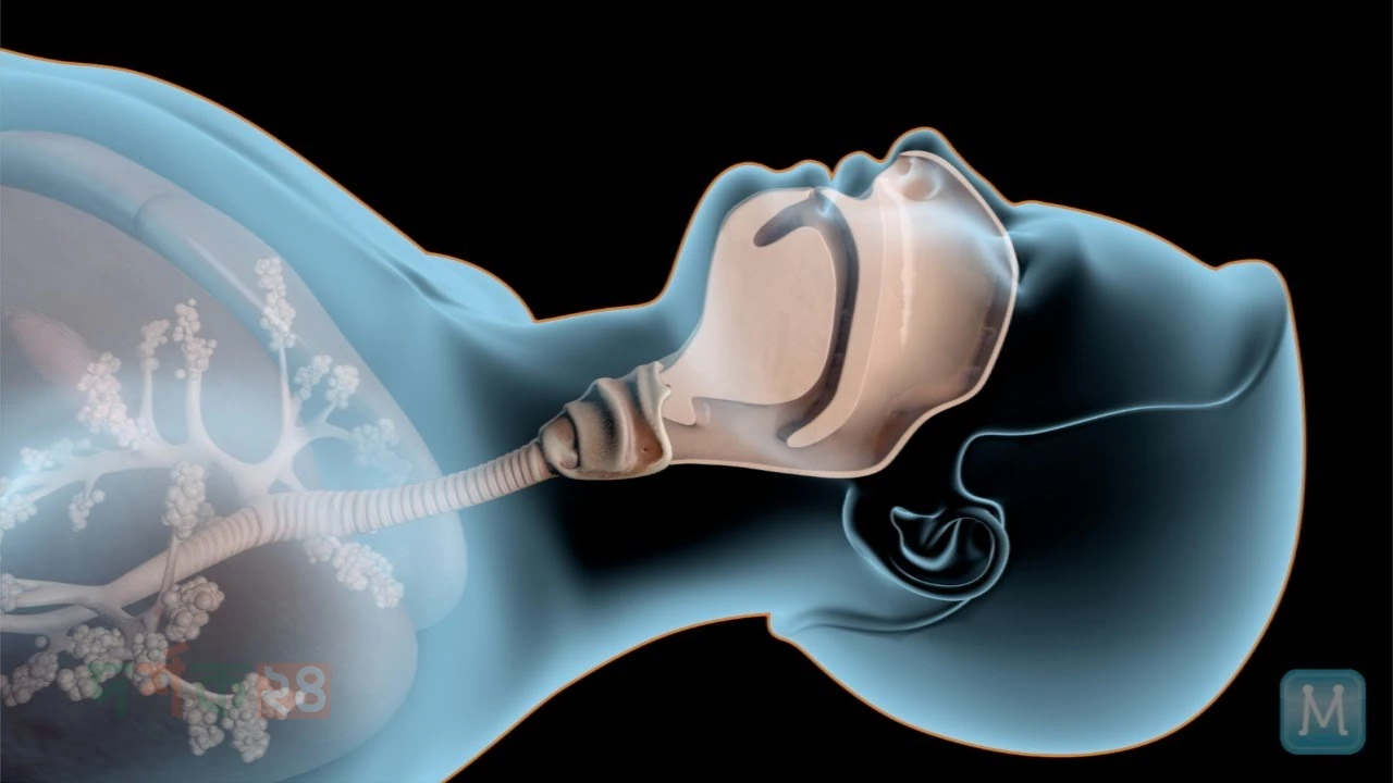 sleep-apnea-risk-weekend
