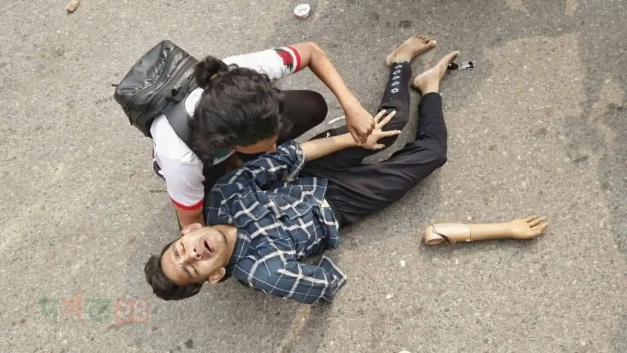 july-sonod-attoho-joddha-attacked-artificial-hand